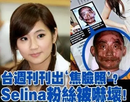 曝光春天剧组爆炸现场照 追踪selina俞灏明烧伤事件始末