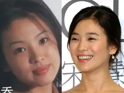大S范冰冰<em>杨幕</em>等<em>整容前后</em>对比照遭曝光的30位
